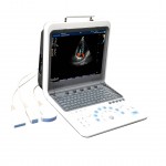 TH-5100 portable color doppler ustrasound system for high-end user